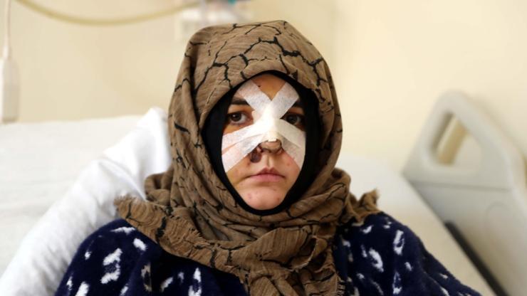 Kaldırım taşıyla öldüresiye dövüldü! Nazlı'nın yardım çığlığı