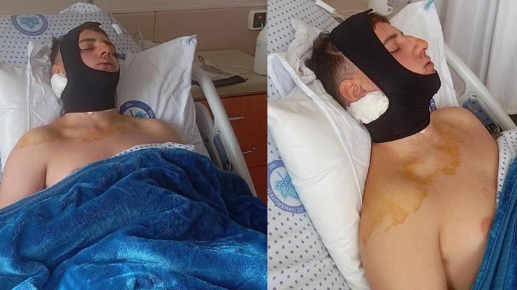 Akran zorbalığına tutuklama kararı! Okul arkadaşlarının omuriliğini ve çenesini kırdılar