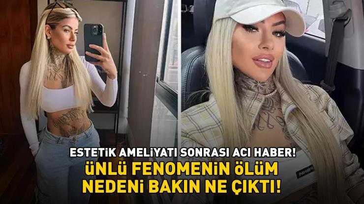 Estetik ameliyatı sonrası acı haber Bianca Dias hayatını kaybetti Ölüm nedeni bakın ne çıktı