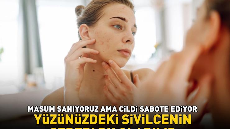 Yüzünüzdeki Sivilcenin Sebebi Bu Olabilir Masum Sandığınız O Yiyecekler Cildinizi Sabote Edip Akneye Davetiye Çıkarıyor