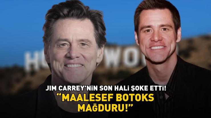 Jim Carrey'nin son hali şoke etti! 'Maalesef botoks kurbanı!'