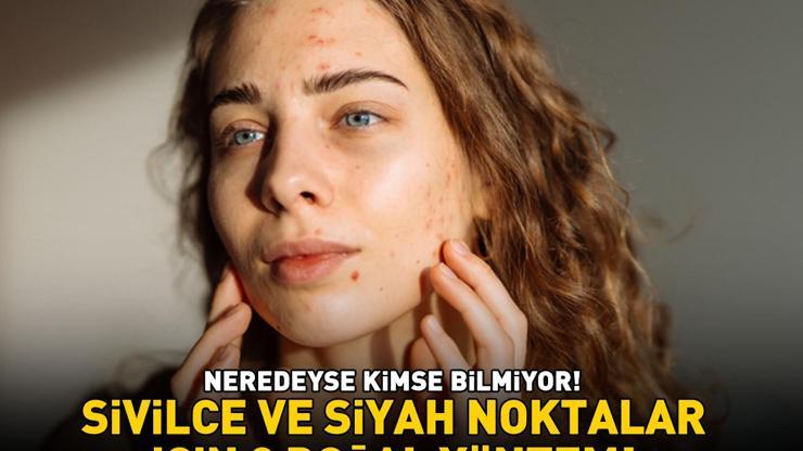 Siyah nokta, sivilce ve akneler için etkili 3 doğal yöntem Neredeyse kimse bilmiyor: Ciltteki yağı dengeliyor, gözenekleri sıkılaştırıyor
