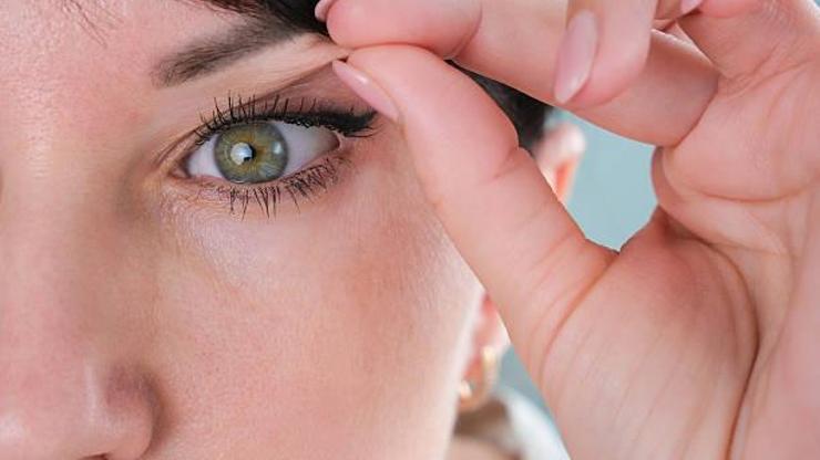 Göz kapağı sarkması hangi durumlarda ciddiye alınmalı?