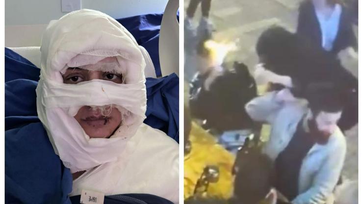 Genç kadını kolonya döküp ateşe vermişti... Kan donduran savunma: Oraya gidince saçlarını yakma isteği doğdu