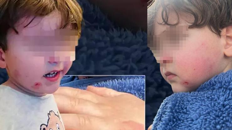 Özel kreşte skandal 2,5 yaşındaki çocuğa darp