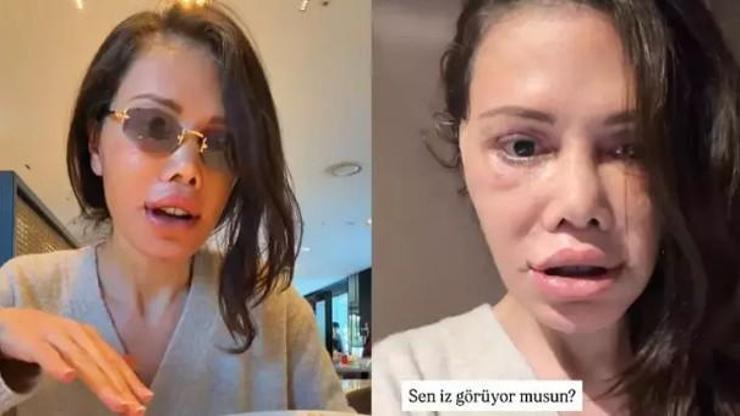 Didem Ceran’dan dikkat çeken paylaşım “Bu bir estetik değil, yeniden doğuş”