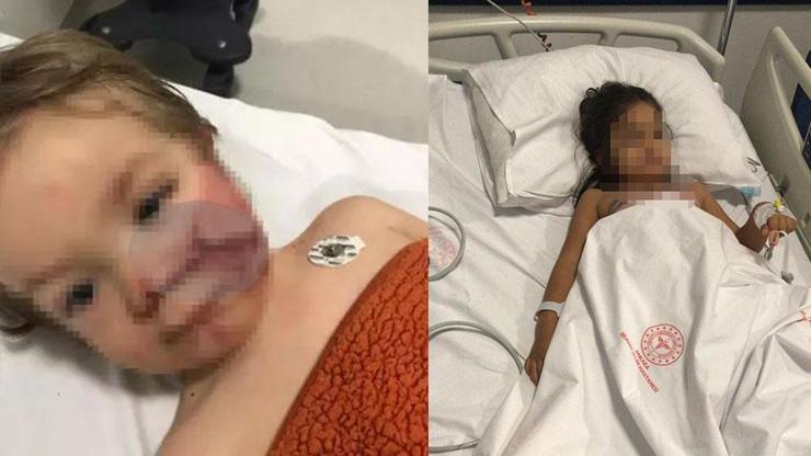 2 kardeşi yaralayan pitbullun sahibine tahliye 2 kardeşi yaralayan pitbullun sahibine tahliye