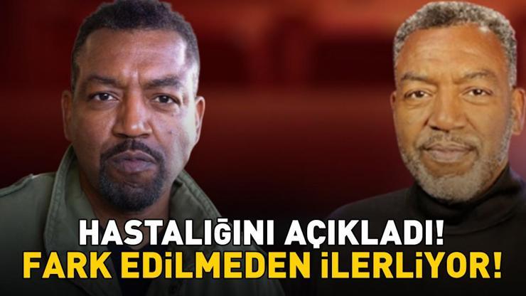 Grey’s Anatomy'nin Yıldızı Russell Andrews Hastalığını Açıkladı! Bu Belirtilere Dikkat! Fark Edilmeden İlerliyor!