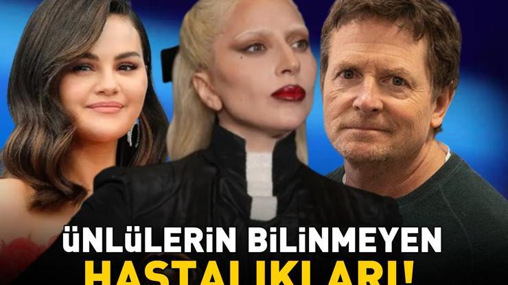 Duyan Şaşırıyor Ünlülerin Bilinmeyen Hastalıkları
