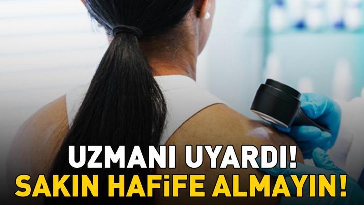  ‘Cildinizdeki değişimleri hafife almayın’