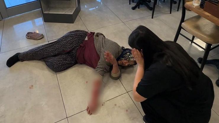 Dinlenme tesisinde dehşet Sahipsiz köpek kolunu kopardı