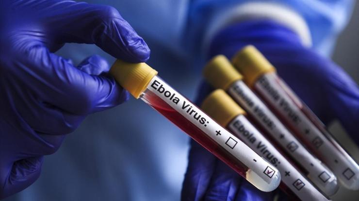 İsrailde ilk Ebola şüphesi Hasta karantinaya alındı