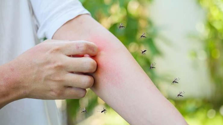 Kaşıntı, Kızarıklık, Şişlik… Böcek Isırığında Bu Belirtiler Alarm İşareti Ne Zaman Doktora Gidilmeli