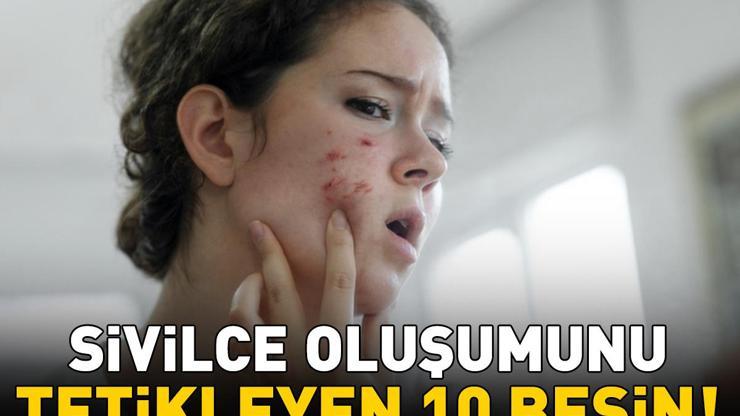 Sivilce oluşumunu tetikleyen 10 besin Tüketmeden önce bir daha düşünün Akne ve siyah noktaya yol açıyor