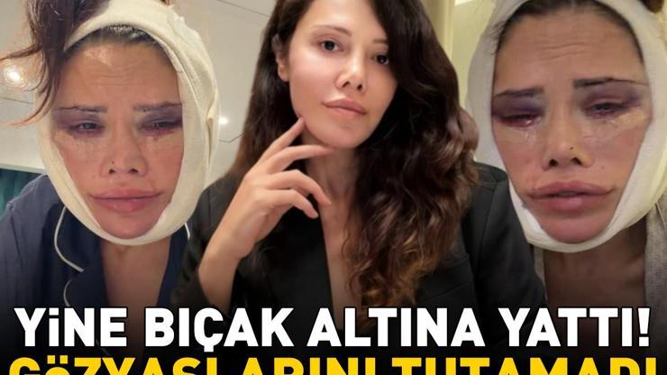 Yüz nakli olan Survivor Didem Ceran, bir kez daha bıçak altına yattı Gözyaşlarını tutamadı