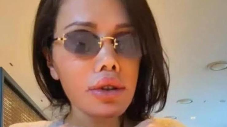 Yüzünde komplikasyon gelişti Didem Cerandan korkutan açıklama: Yeniden ameliyata girebilirim