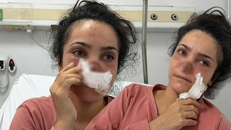  Acıyla balkondan atlamayı bile düşündüm