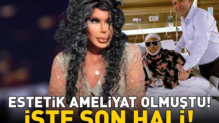 Estetik ameliyat olmuştu İşte 74 yaşındaki ünlü sanatçı Bülent Ersoyun son hali...