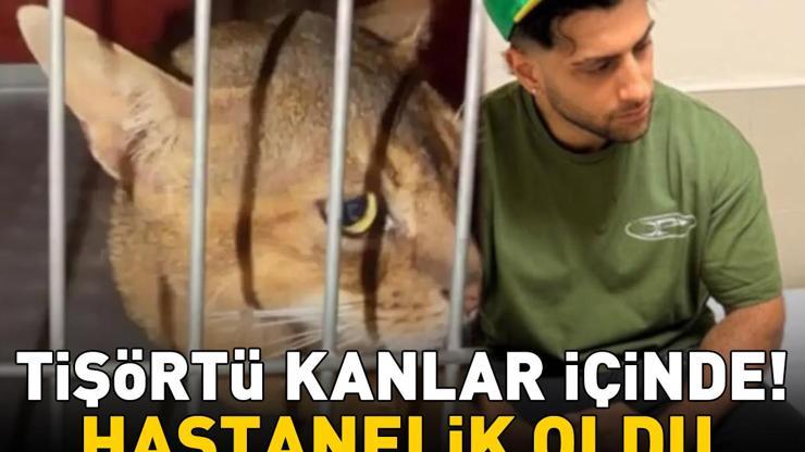 REYNMEN HASTANELİK OLDU Kedisinin Saldırısına Uğrayan Ünlü Şarkıcının Tişörtü Kanlar İçinde Kaldı