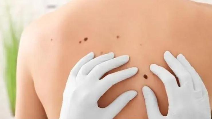 Et benleri metabolik hastalıkların habercisi olabilir
