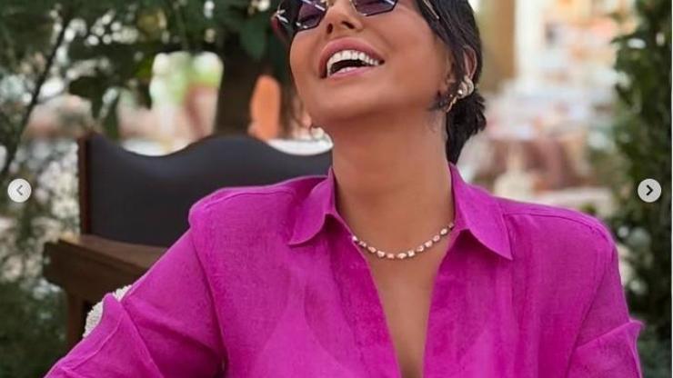 Ebru Gündeş’in Son Hali Gündem Oldu 10 Milyon TL’lik Estetik İddiası Yeniden Konuşuluyor