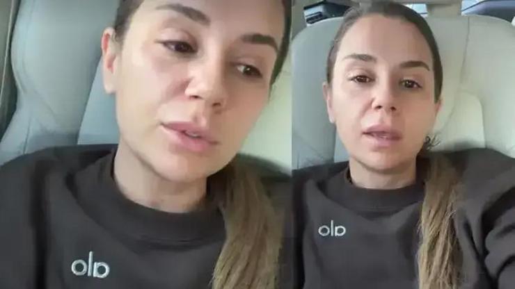 Merdivenden Düşmüştü Merve Özbey Sağlık Durumunu Açıkladı