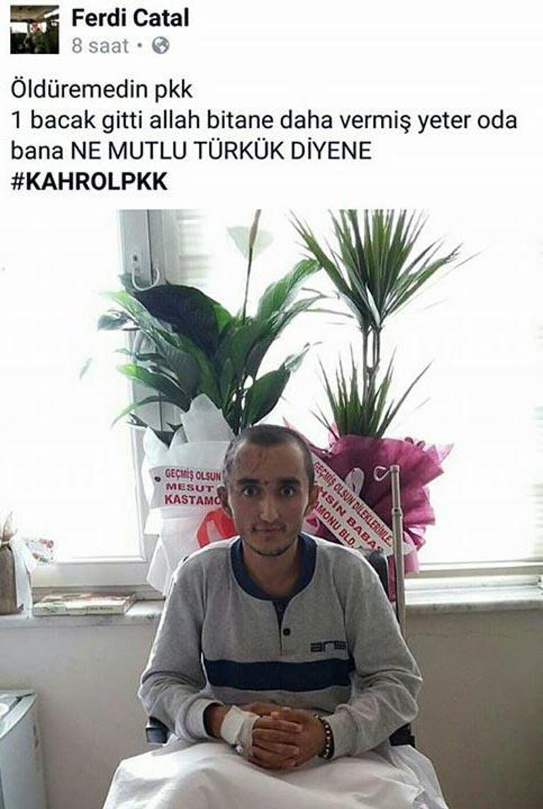 Gazinin mesajı: Öldüremedin PKK bir bacak gitti