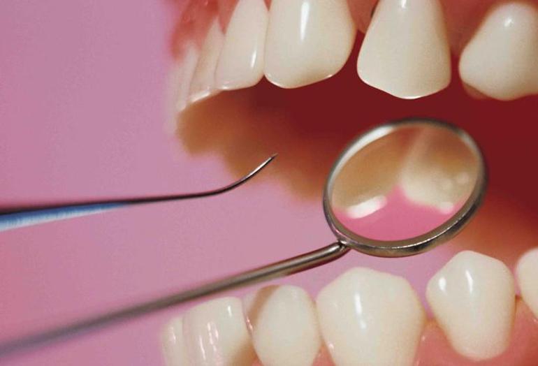 Diş eksikliği bunama sebebi olabilir