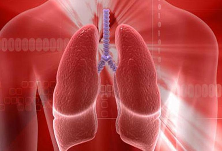 Tüberküloz hastalarında akciğer kanseri riski