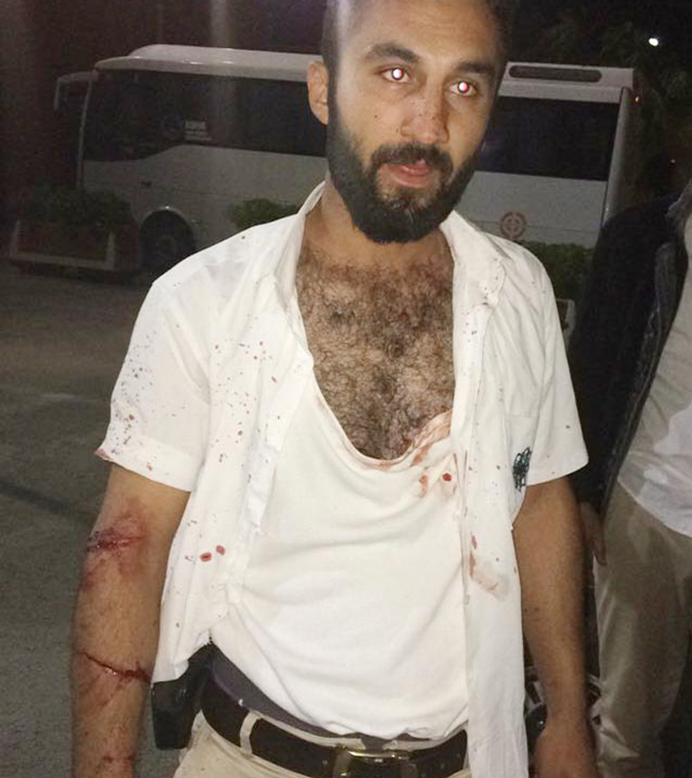 Konyada otobüs şoförü bıçaklanıp, dövüldü