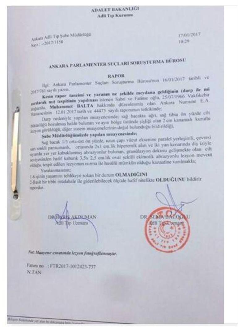 Adli Tıp ’AK Parti Trabzon Milletvekili ısırıldı’ dedi