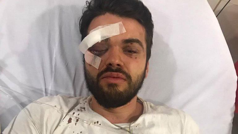 Eşcinsel ragbi sporcusu 7 kişinin saldırısına uğradı