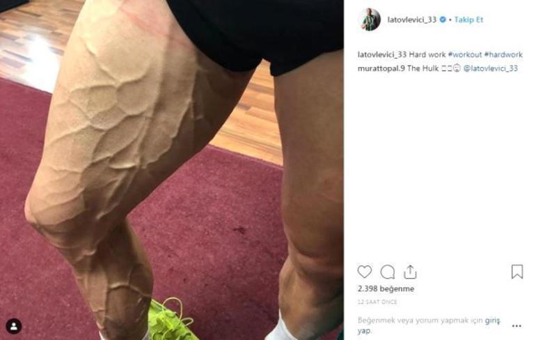 Latovlevici bacağının son halini paylaştı