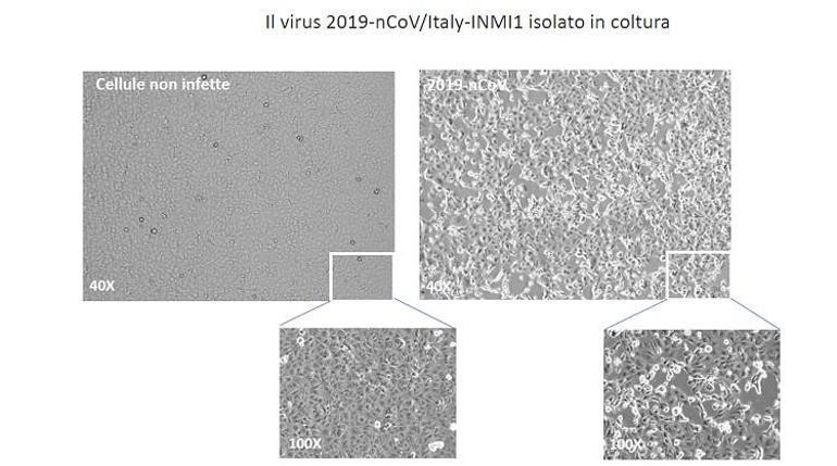İtalya Sağlık Bakanı Sperenza: Koronavirüsü izole ettik