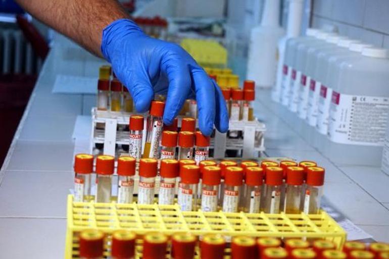 İstanbul Tıp Fakültesi Koronavirüs Laboratuvarında antikor testi yapılmaya başlandı
