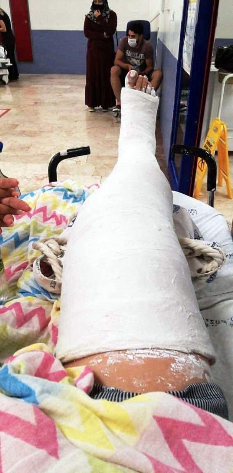 Mazgal kapağındaki kırık nedeniyle bacağı kırıldı | Video