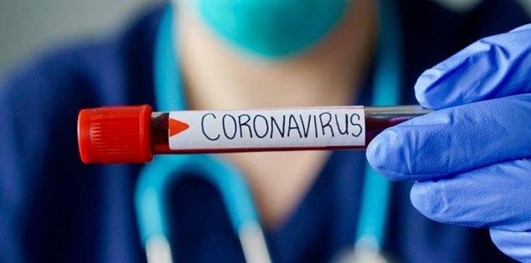 Sars virüsü nedir, nasıl bulaşır, belirtileri neler Çin Sars virüsü ile koronavirüs arasındaki farklar neler
