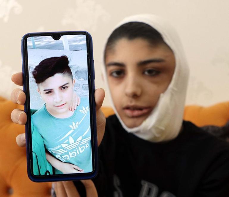 Gaziantepte 13 yaşındaki Berat yardım istiyor