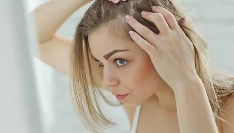 Saçkıran (Alopesi Areata) Nedir, Neden Olur Saçkıran Belirtileri Nelerdir, Nasıl Tedavi Edilir
