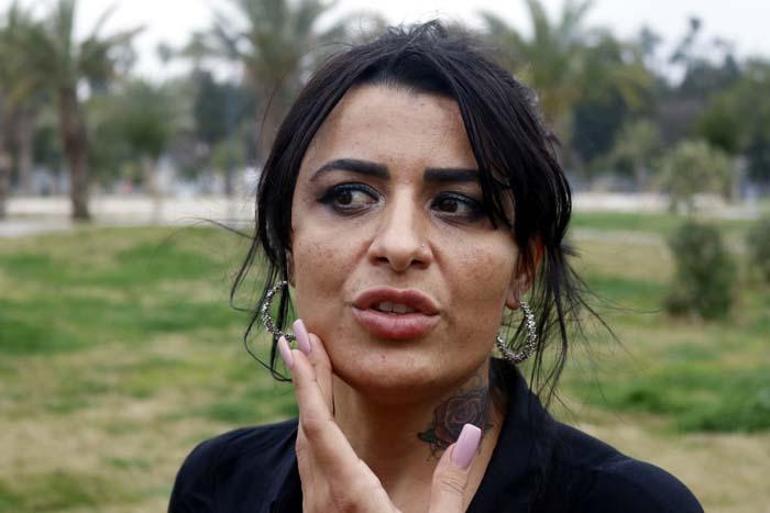 Estetik uğruna yüzü yanan kadın, aynalarla barıştı