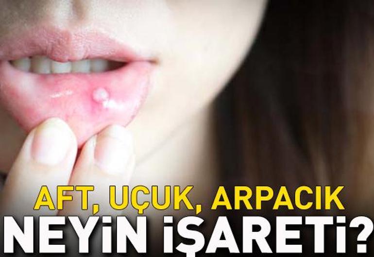 17 Ekim 2022 Pazartesi gününün son dakika önemli gelişmeleri (CNN TÜRK 11.30 bülteni)