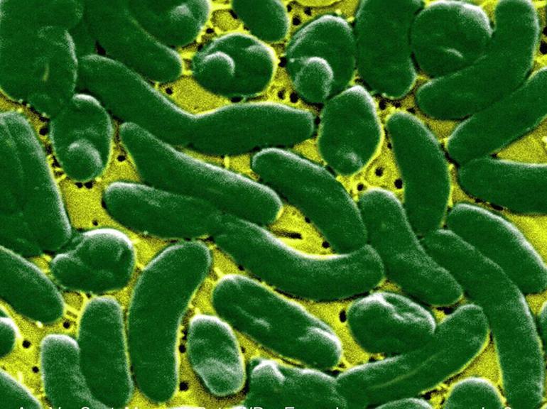 ABDde kasırganın ardından et yiyen bakteri alarmı