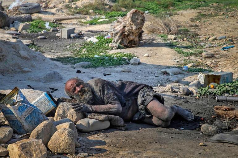 İran’da yaklaşık 70 yıldır yıkanmayan adam, banyo yaptıktan haftalar sonra öldü