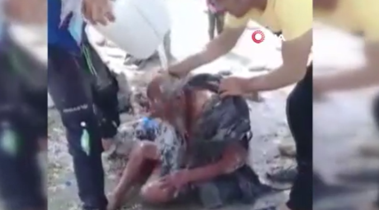 İran’da yaklaşık 70 yıldır yıkanmayan adam, banyo yaptıktan haftalar sonra öldü