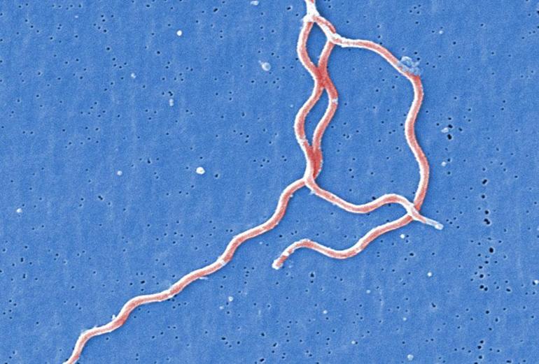 ‘Sessiz pandemi’ Lyme: 350 hastalığı taklit edebiliyor