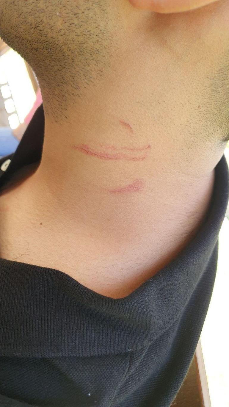 Kirayı yaklaşık 4 kat artırmak istedi: Kabul etmeyen kiracıyı yakınlarıyla birlikte dövdü