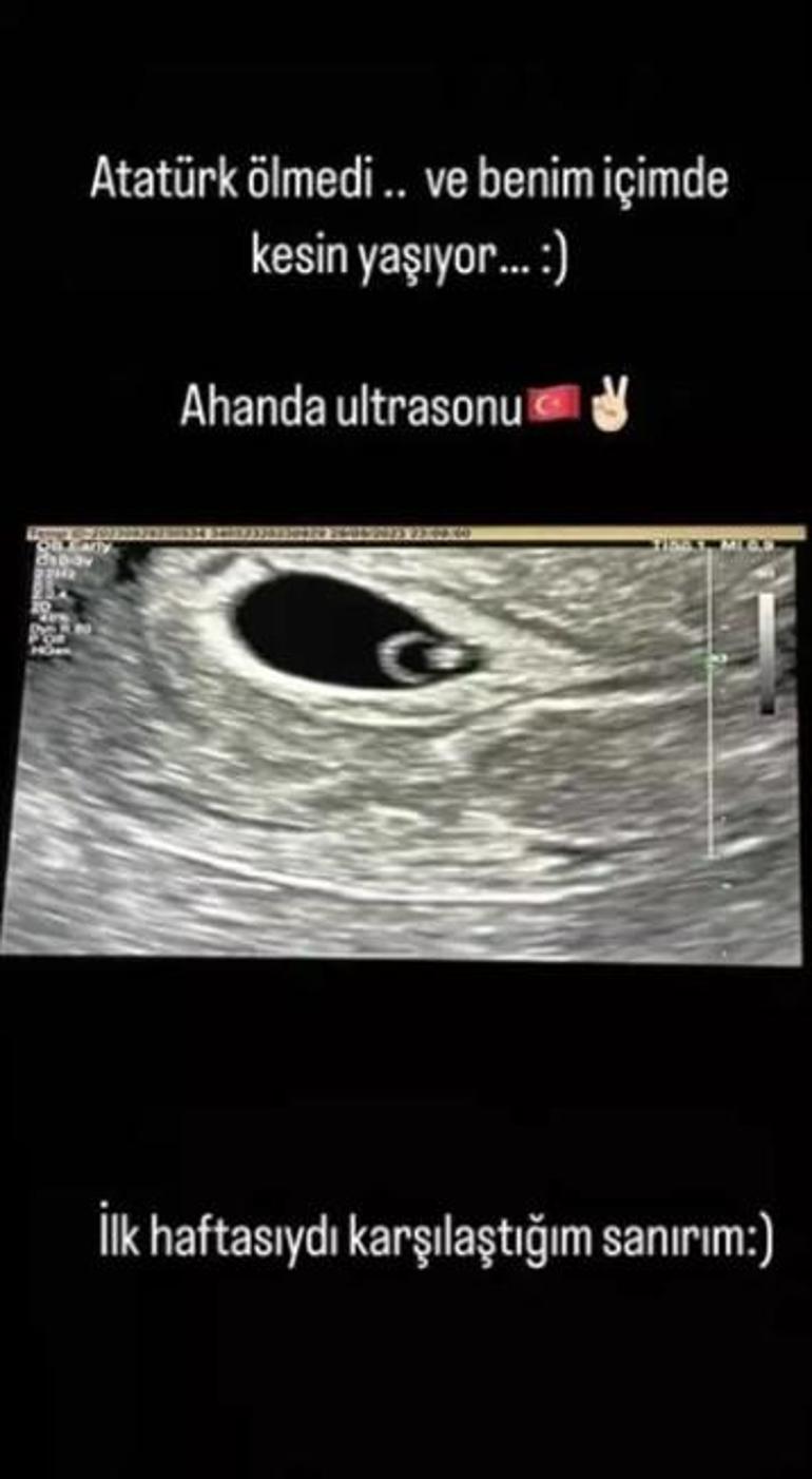 Gonca Vuslateri, bebeğinin ultrason görüntüsünü paylaştı