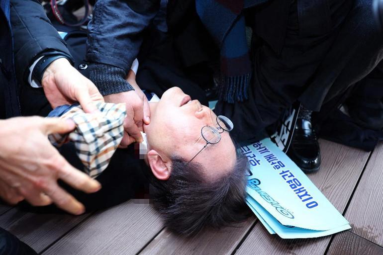 Saldırgan imza isteme bahanesiyle yaklaştı: Güney Koreli muhalif lider boynundan bıçaklandı