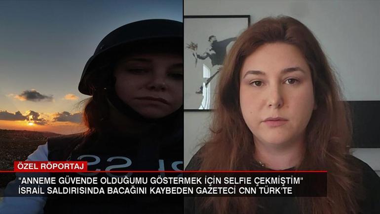 İsrail saldırısında bacağını kaybeden gazeteci CNN TÜRK’e konuştu: Adalete inanmıyorum