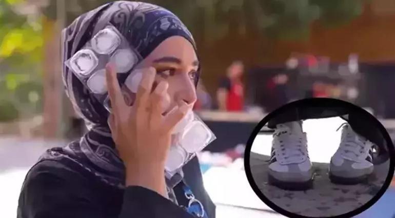 MASTERCHEF BEYZAYA NE OLDU, MASTERCHEFTEN AYRILDI MI Kızgın yağ dökülen ve yüzü yanan Beyza Aydının son durumu